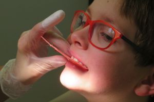 20 de mii de aparate dentare pentru copiii din Capitală
