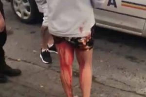 VIDEO: Imagini scandaloase surprinse pe o stradă din Galaţi. Fată plină de sânge, ignorată de agenţii de poliţie