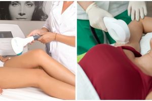 Redescoperă frumuseţea pielii fine în Centrele EstetPRO. Află tendinţele în materie de epilare