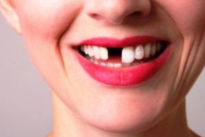 Alarmant: românii vin la dentist doar când le cad dinţii! Ce recomandă stomatologii