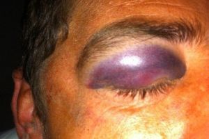 Un botoşănean şi-a ucis colegul de cameră după ce acesta ar fi încercat să îl pipăie. Cum a fost pedepsit