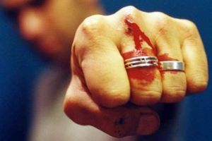 Tânăr reţinut pentru tentativă de omor după ce şi-a înjunghiat un vecin