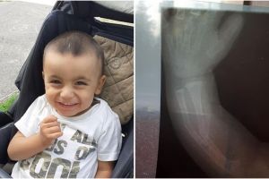 FOTO Un băieţel din Agnita are nevoie de ajutorul nostru – Are boala „oaselor de sticlă”