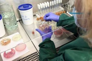 Epidemie de LISTERIOZĂ în Europa: Trei morţi şi peste 200 de persoane infectate în Spania