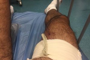 Ghinion pentru un tânăr din Botoşani. A plecat cu bicicleta la munte, dar a ajuns la spital