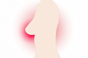 Cancerul de sân – cum te pot proteja ceapa şi usturoiul