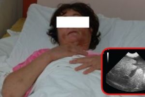 Şi-a iubit bărbatul, mai mult decât… ficatul