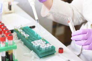 Leptospiroza: Ce complicaţii poate da această boală