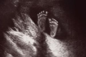 În pericol să piardă sarcina după accident!