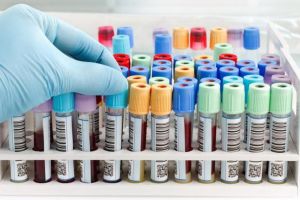 Filarioza: Cum te poţi alege cu această boală şi cum se manifestă