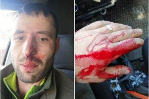 Pădurarul din Moldoviţa, care apare în filmarea Recorder despre hoţii de lemne, a fost ...