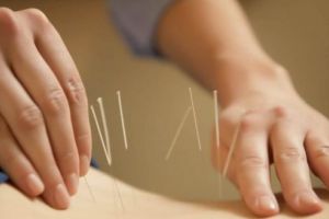 Workshop Internaţional în Medicina Tradiţională Chineză & Thailandeză comparativ cu Medicina Occidentală pentru Terapia şi Managementul Durerii