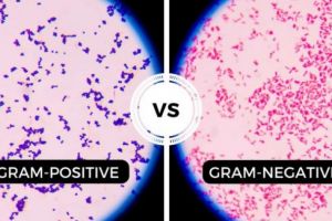 Un nou trend pe piaţa produselor naturiste: Cânepa Medicinală