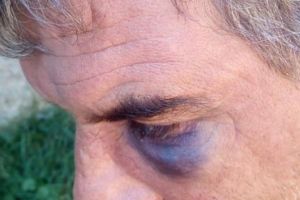 O femeie şi-a bătut bărbatul, după o ceartă. De frică, omul a cerut ordin de protecţie