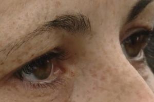 Caz revoltător – Femeie cu arsuri grave plimbată între trei spitale preţ de două săptămâni