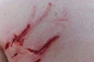 O nouă ALERTĂ în Mureş! Paznic atacat de un urs, internat la SMURD!