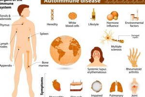 Bolile autoimune – ce sunt şi cum ne afectează acestea?