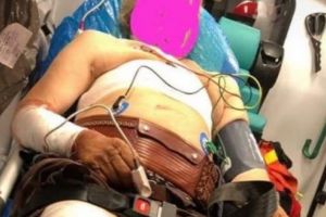 Ciobanul din Cucerdea atacat în timpul somnului de urs!