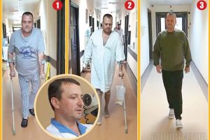 Din nou pe picioare: Bărbatul operat la Oradea de coxartroză bilaterală printr-o tehnică revoluţionară s-a recuperat complet! (VIDEO)