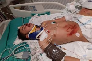 Adolescentul rănit grav după ce a fost lovit de tren are nevoie de sprijin financiar