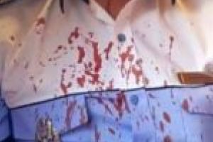 Condamnat pentru tentativă de omor a unui poliţist! L-a lovit cu toporul în cap!