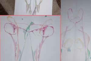 Apel umanitar pentru o fetita din Constanta diagnosticata cu cancer. Licitatie pe Facebook pentru cazul Alexandrei (galerie foto)