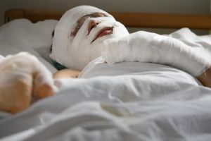 FOTO. Victimele exploziei din Satu Mare, cu arsuri grave pe faţă şi pe mâini