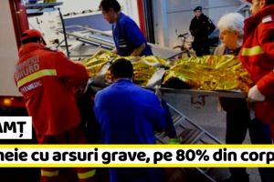 NEAMȚ: Femeie cu arsuri grave, pe 80% din suprafaţa corpului