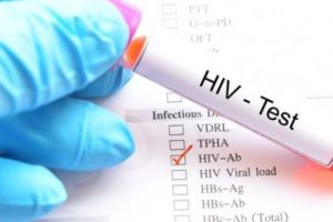 10 argeşeni au HIV