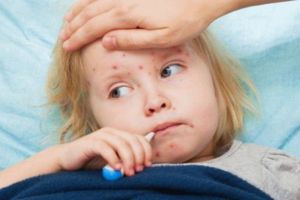 Braşovul, printre judeţele cu cele mai multe cazuri de rujeolă înregistrate în ultima săptămână