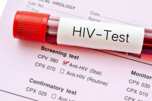 DSP Bihor aminteşte că testările pentru depistarea HIV-SIDA sunt gratuite, iar tratamentul prelungeşte şi îmbunătăţeşte viaţa