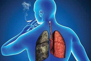 Bolnavii de cancer pulmonar, victime ale birocraţiei