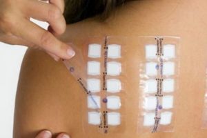 Oare pot să tratez eczema sau să previn?