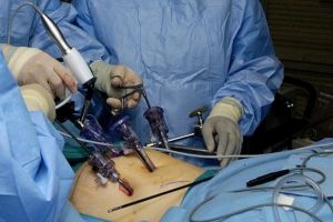 Intervenţie chirurgicală în premieră la Spitalul de Urgenţă din Ploieşti. O echipă de tineri chirurgi a reuşit să execute o intervenţie complicată, total laparoscopic