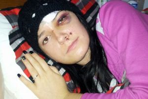 O cântăreaţă din Iaşi a fost desfigurată de un hoţ! Medicii i-au prins toţi dinţii cu sârmă. Cum arată acum!