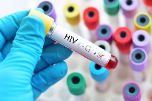 Toată populaţia, test pentru HIV! Un medic de la Infecţioase aruncă bomba. News Alert