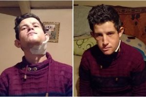 Majorat cu scandal – Tânăr sibian băgat în spital de trei indivizi beţi