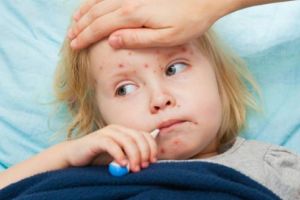 Autorităţile au înregistat 56 de cazuri noi de rujeolă, în ultima săptămână. În total, sunt 9.289 de cazuri de rujeolă raportate până vineri