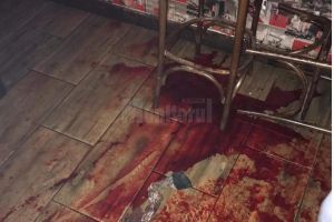 Agent de pază, atacat de un grup de tineri şi înjunghiat de mai multe ori în faţa unui bar ...