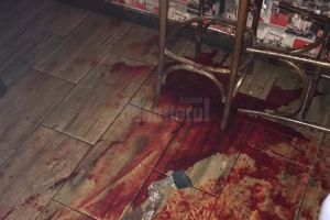 Un agent de pază care a intervenit între două grupuri de bătăuşi, înjunghiat de mai ...