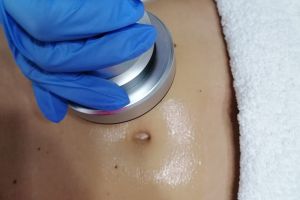 Vrei să scapi de kilogramele în plus? Un salon din Botoşani are super oferte la tratamentele pentru slăbit