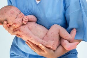 Un virus face tot mai multe victime. 13 noi cazuri în Satu Mare