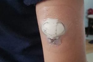 Demersuri pentru soluţionarea crizei provocată de lipsa senzorilor de glicemie în Mureş