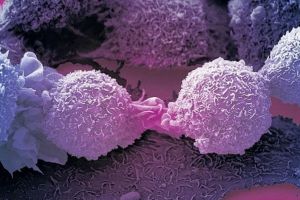 A fost descoperită celula care ar putea sta la baza unui tratament universal împotriva cancerului!