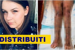 FOTO. Tânăra (21 ani) arsă în explozia din Satu Mare, cu picioarele distruse. Are nevoie de ajutor!