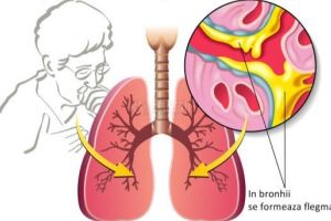 Comunicarea între medic şi pacient. Ce este expectoraţia?