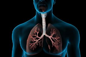 Ce este embolia pulmonară?