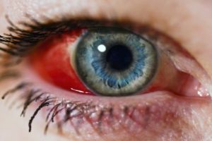 Ce sancţiune a dat Direcţia de Sănătate Publică în cazul incidentului de la Școala 11