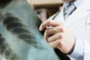 Premieră în România la Spitalul Judeţean din Timişoara! O nouă aplicaţie pentru analizarea radiografiilor pulmonare mai rapid