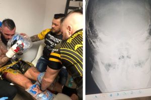 K1: Ristea a continuat să lupte cu mandibula şi degetul rupt! Nu degeaba i se zice “Gladiatorul”!